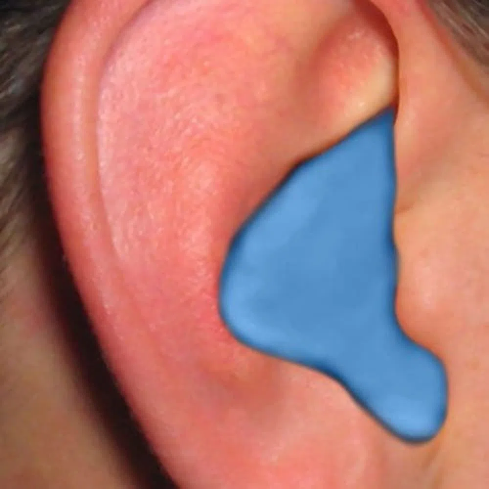 Radians Bouchons d'oreilles moulés sur Mesure
